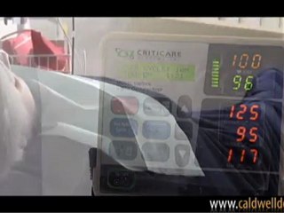 Sedation Dentistry - Caldwell DDS - Orange County, California