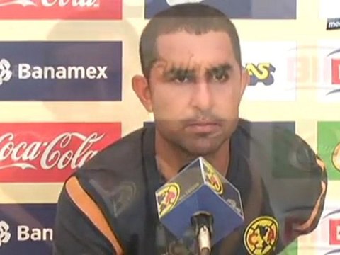 MT - América, 7 de septiembre 2011