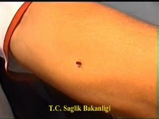 GAZİOSMANPAŞA BÖCEK İLAÇLAMA