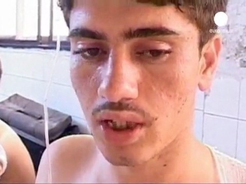 Pakistan’da okul aracına kanlı saldırı