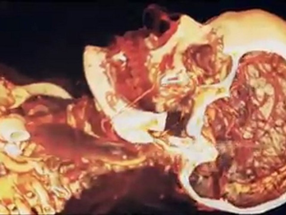 PLAYMEN   ALEX LEON ft. T-PAIN - Out Of My Head   Official Video Clip