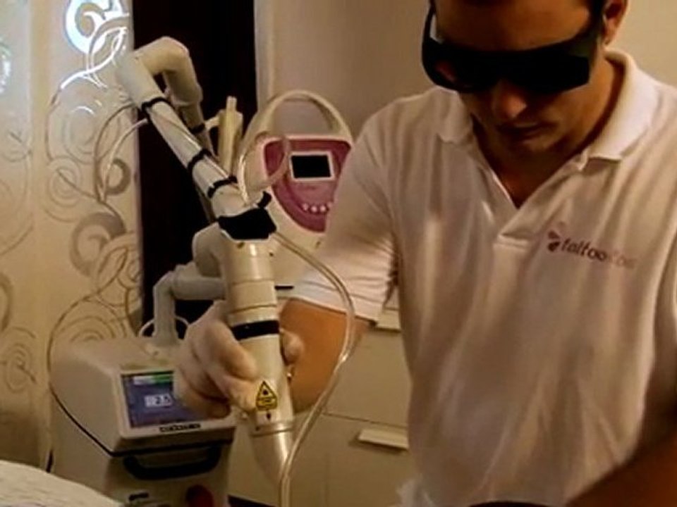 Tattooentfernung mit Laser - wir zeigen wie es geht