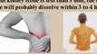 kidney stone relief - kidney stone pain relief - kidney stone home remedy