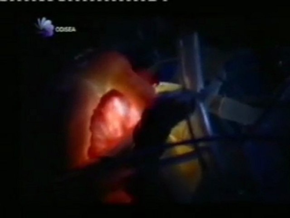 El corazon: Anatomia funcional