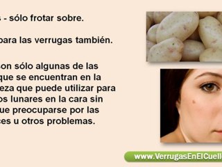 eliminar lunares de la cara