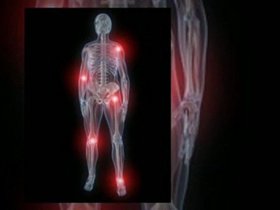 Remedies For Gout – Some Reliable Information