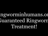 ringworm treatment for humans; treatment for ringworm in the US, ringowm treatment in humans