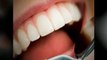 Burlington Dentist – Affordable Burlington Dentists
