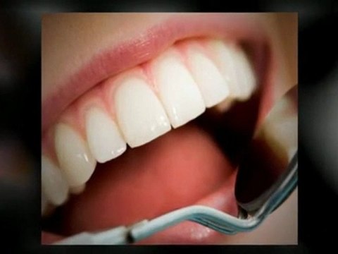 Burlington Dentist – Affordable Burlington Dentists