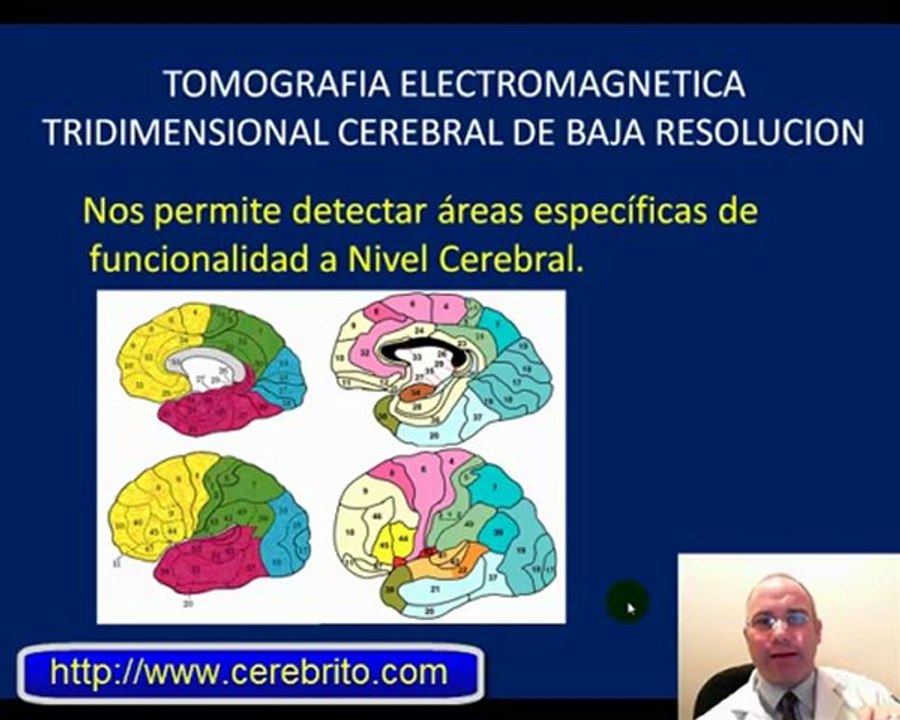 Manual Del Videoelectroencefalograma Eeg Con Mapeo Cerebral Y