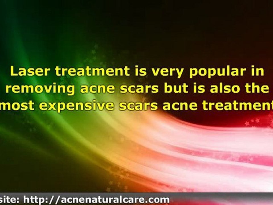 Different Scars Acne Treatment You Can Try
