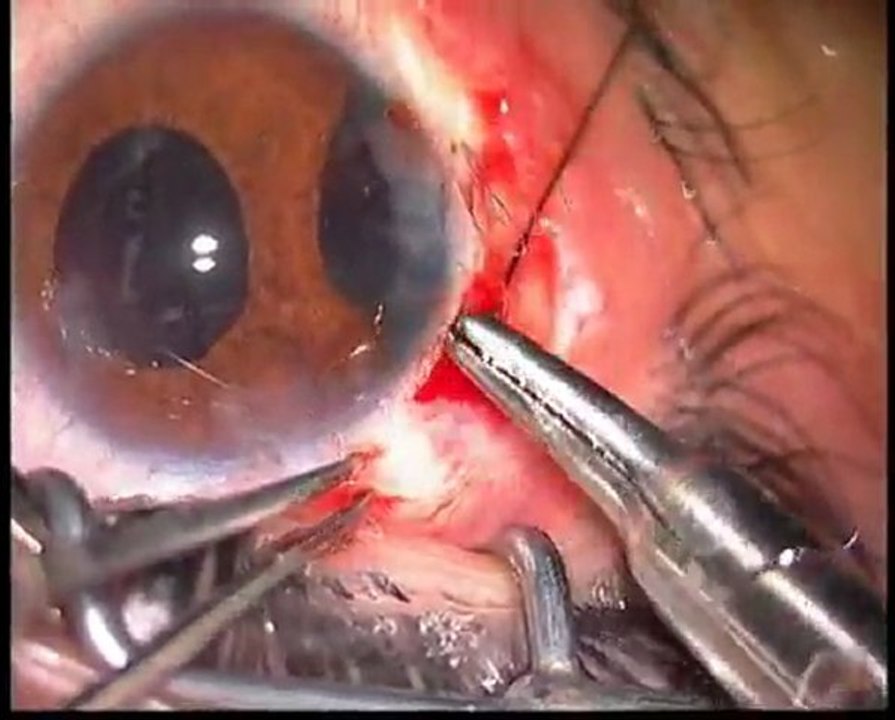 ahmet segment1