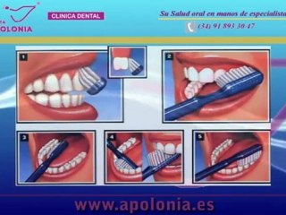 Me sangran las encias al cepillarme, cual es la causa?