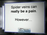 Family Physician Discusses Spider Vein Options