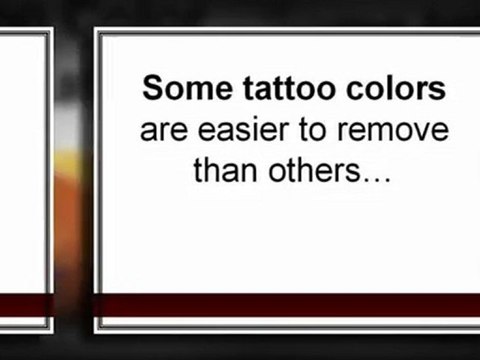 4 Things You Need to Know Before Tattoo Removal