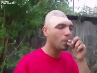 Incroyable crâne – déformation surprenant