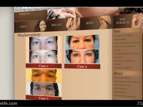 Cosmetic Surgery Brooklyn & Manhattan - New Look New Life Surgical Arts