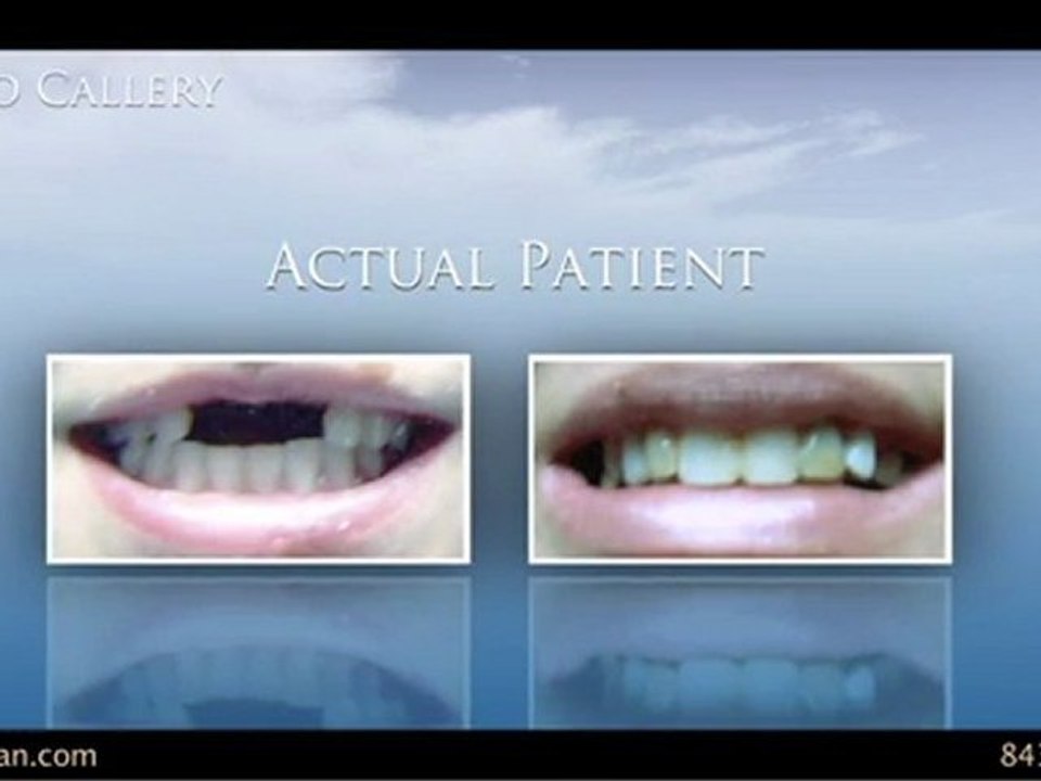 Cosmetic Dentist in Myrtle Beach & Surfside Beach, SC