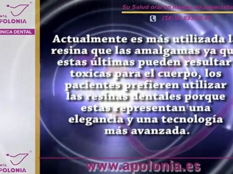 Resinas Dentales - Dentistas en Madrid