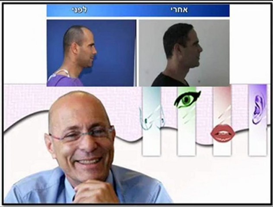 העברת מתלי שיער - לטיפול איכותי ויעיל בהתקרחות