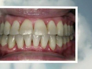 Orthodontist Aurora CO Sept2011