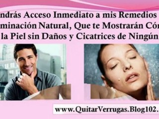 como curar verrugas en las manos