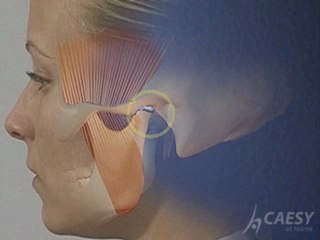 Oxford Valley Dental Excellence Implant Supported Bridge