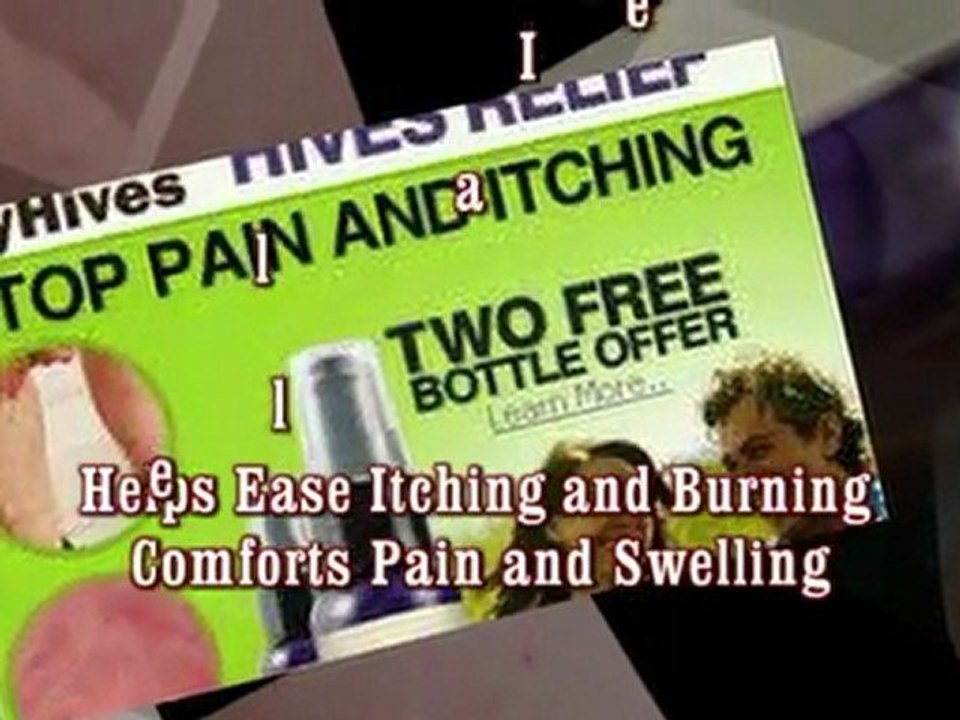 Hives Treatment