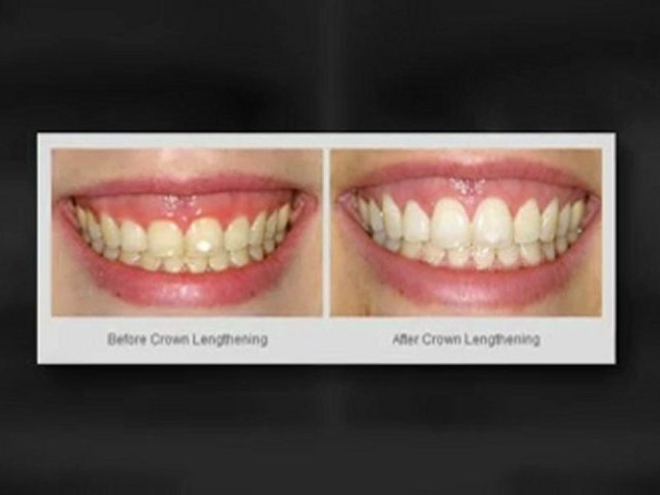 Dentist Seattle