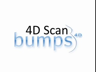 Bumps4D 4D Baby Scan For Maternal Bonding