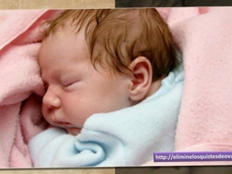 pinchazos en los ovarios - dolor de ovarios en el embarazo - quiste en los ovarios