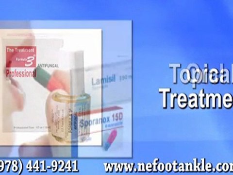 Fungal Toenails - Podiatrist in Chelmsford and Newburyport,