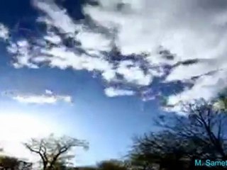 TSM İle Terapi (37) Sonsuzluk Gerçeği Arayış (Perküsyon)