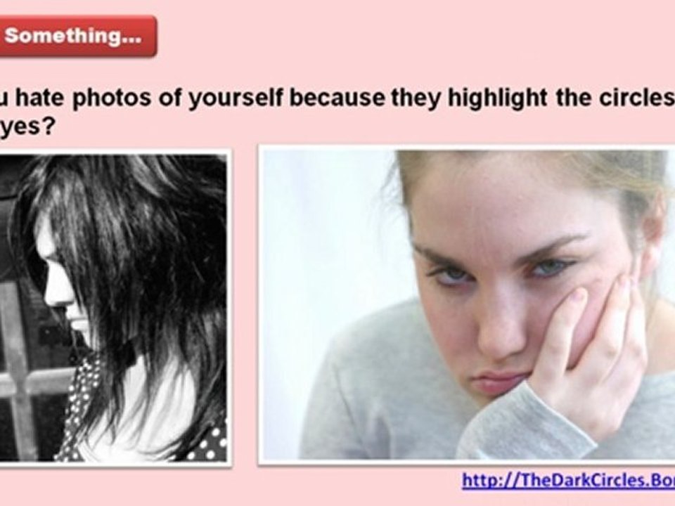 dark circles under eyes treatment - dark circles home remedies - how to remove dark circles