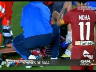 Brutal entrada de Tony Doblas a Ion Vélez..6 meses de baja