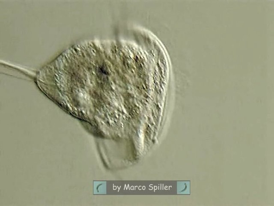 Vorticella