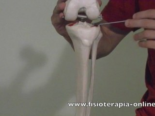 ¿Que es la Artrosis de rodilla?