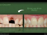 Winston-Salem, NC Cosmetic Dentist – Dr. Andrew Kelly