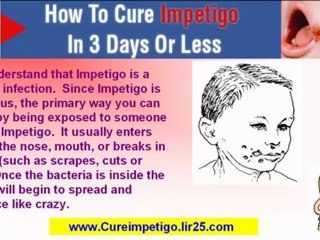 treatment of impetigo - cure for impetigo - how to cure impetigo