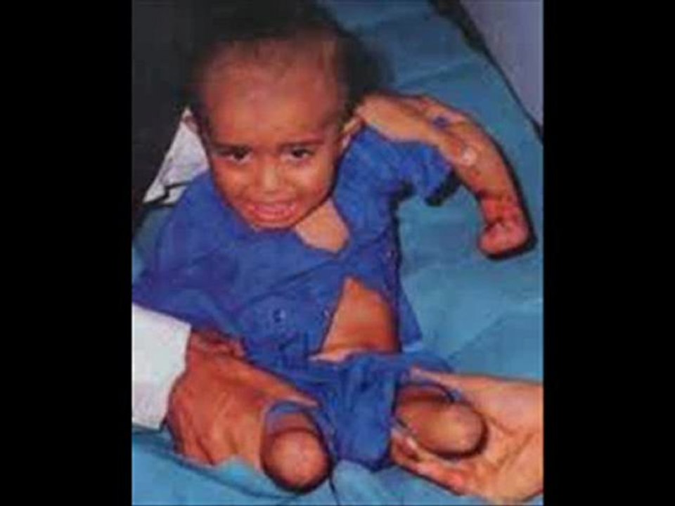 FRAGILE STING - POR EDGARDO LOPEZ