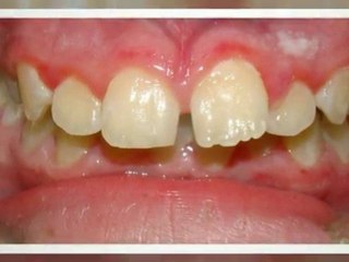 Orthodontist Dallas Oct2011