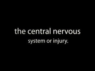 Fibromyalgia Symptoms