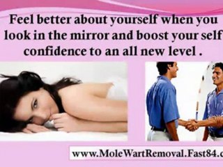 remove skin tags yourself