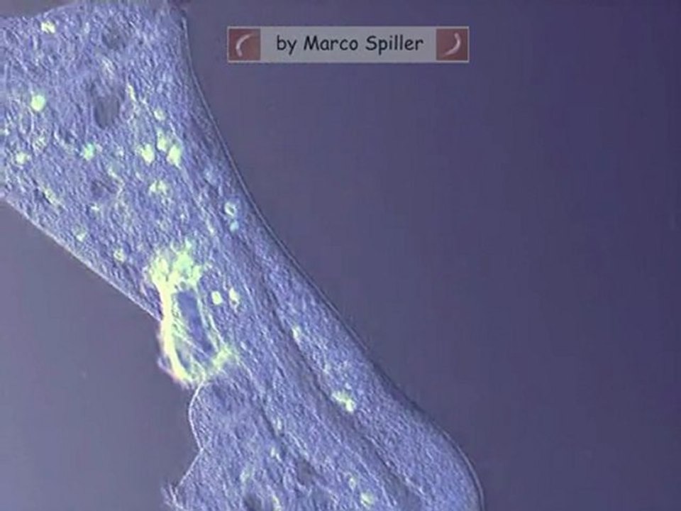 Stentor: binary fission