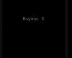 Rayons X - Comètes Astéroides Et Météores Part 1sur6