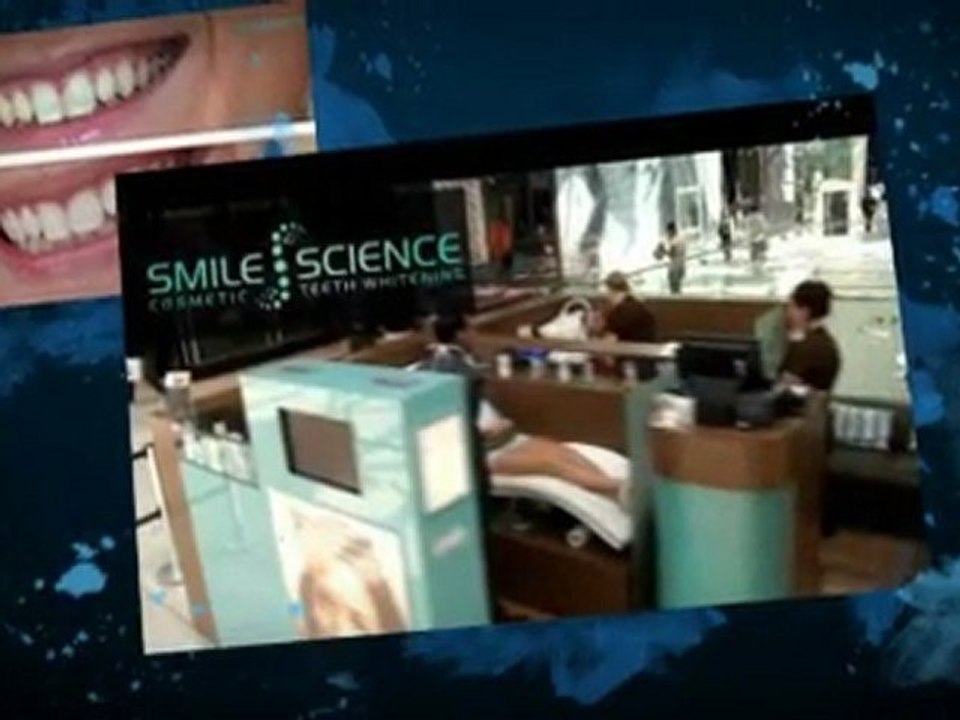 Teeth Whitening In London