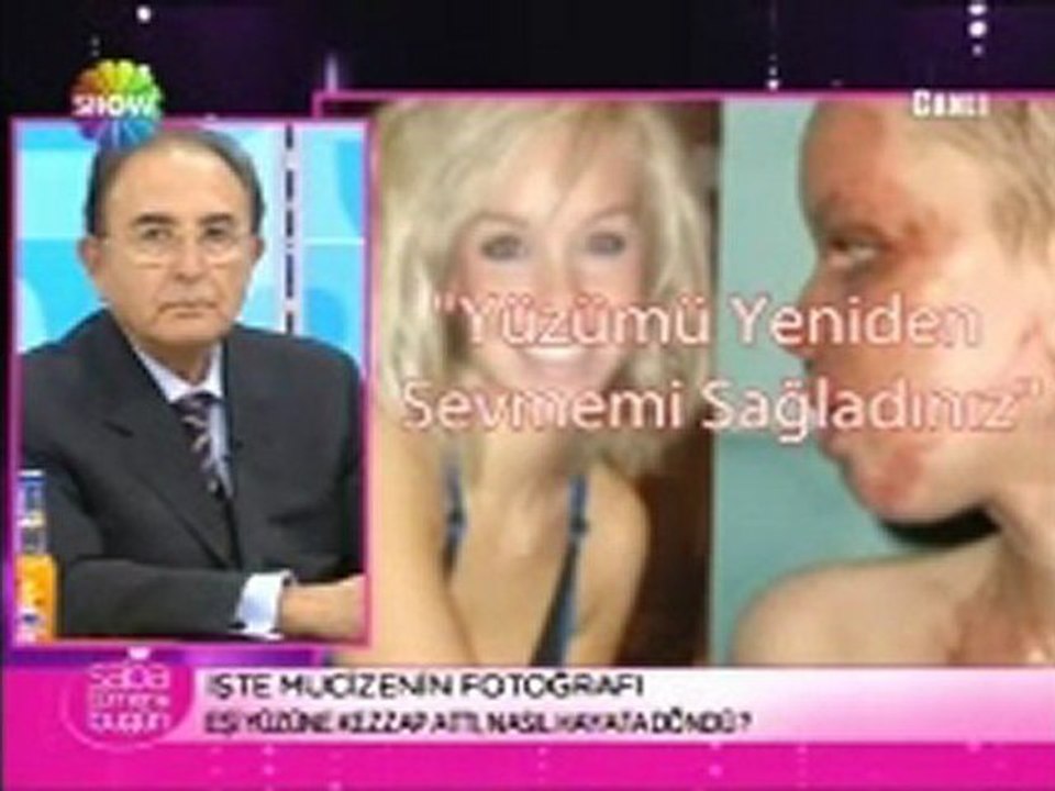 Katie Piper Estetik Ameliyatı- Prof. Dr. Onur Erol - Saba Tümer