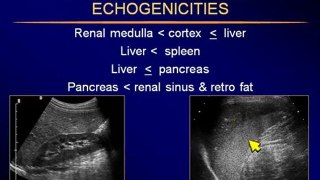 Sonography of the Liver