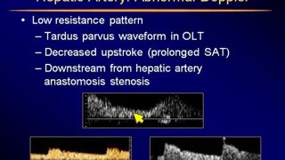 Ultrasound of the Liver part 4