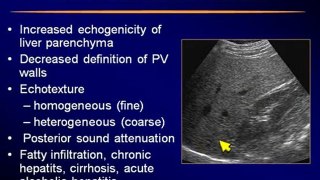 Ultrasound of the Liver part 5